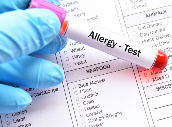 What Is Allergy Testing And Why Is It Important