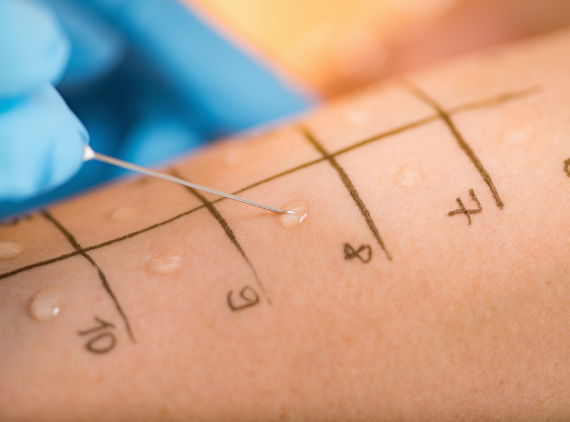 Our Approach to Accurate Allergy Testing