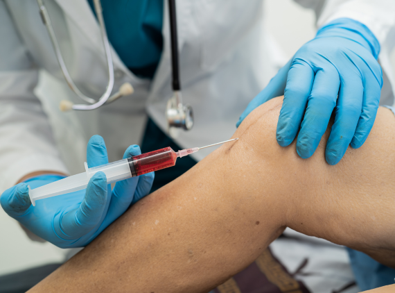 Conditions and Concerns Treated with PRP